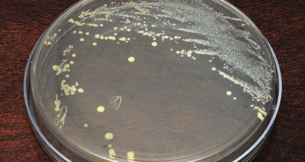 legionella